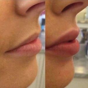 Nu skin lip plumping balm